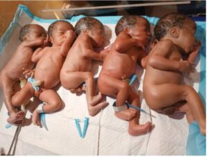 Woman Gives Birth To Five Kids After Ten Years Of Waiting In Marriage